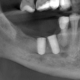 CT Dent CT Dent British Dental Journal Article