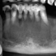 CT Dent CT Dent British Dental Journal Article