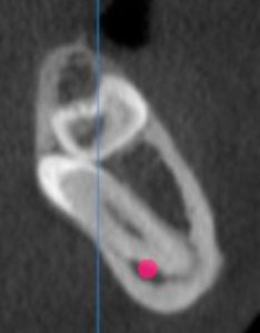 CT Dent  Capture 8  