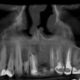 CT Dent CT Dent has been shortlisted as a finalist in the Dental Industry Awards 2018