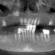 CT Dent CT Dent AI software recently traced a perfect ID nerve in 4.5 seconds - the first time in dental history!