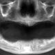 CT Dent Dr Nilesh Parmar discusses his experience of working with CT Dent
