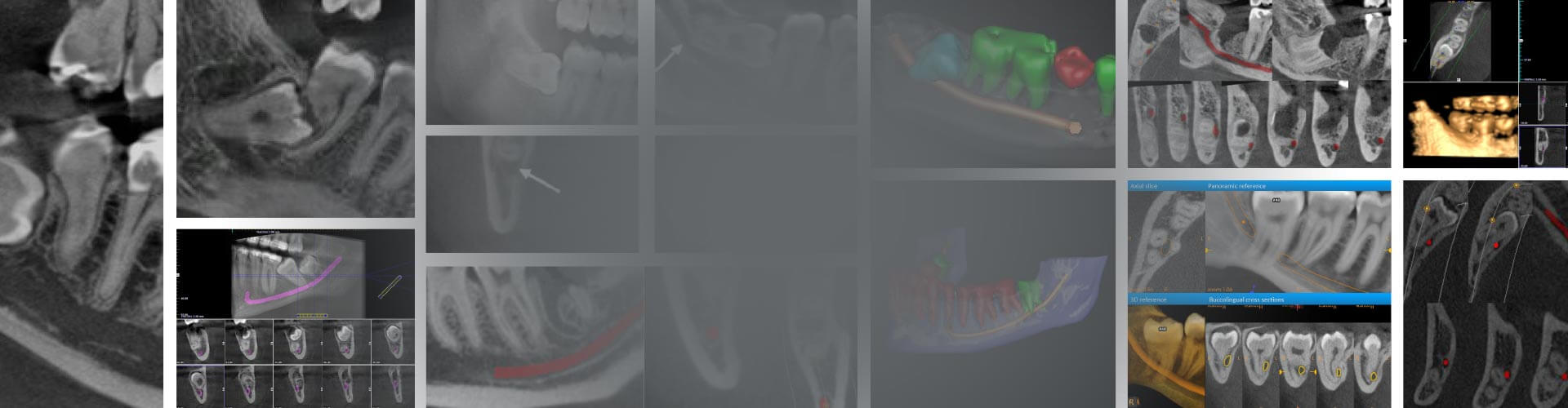 CT Dent  Slider 14  