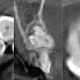 CT Dent  The Importance of CBCT in Implant Dentistry  