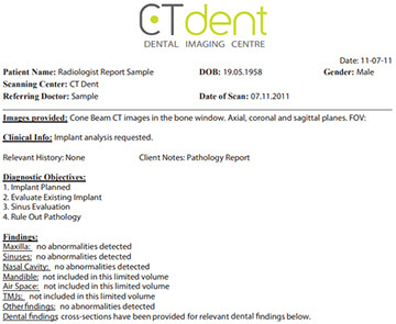 CTDENT Dental Radiology Report CTDENT Dental Radiology Report