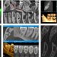 CT Dent Case of the month - Diagnosis of a Bony Lump