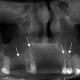 CT Dent Case of the month - Diagnosis of a Bony Lump