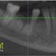 CT Dent 10 years on and still no need to purchase a scanner
