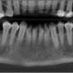 CT Dent Case of the Month - Dentoalveolar Trauma