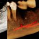 CT Dent Dental imaging that enhances your clinic