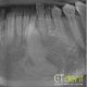CT Dent Patient safety is our priority