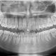 CT Dent Understanding Dental CBCT and Its Role in Maxillary Sinus Evaluation