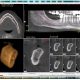 CT Dent Understanding the Essentials: What Should a Dental Radiology Report Include?