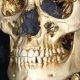 CT Dent Understanding Normal Anatomy on Dental CBCT Scans