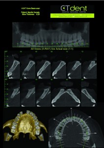 6-600x849