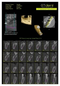 CTDent-DP700-samples Page 01-600x849
