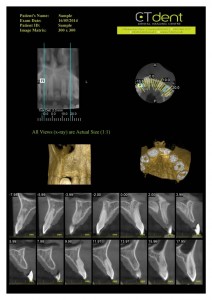 CTDent-DP700-samples Page 04-600x849