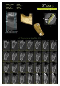 CTDent-DP700-samples Page 08-600x849