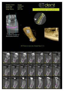 CTDent-DP700-samples Page 09-600x849
