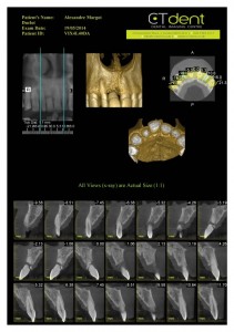 CTDent-DP700-samples Page 10-600x852